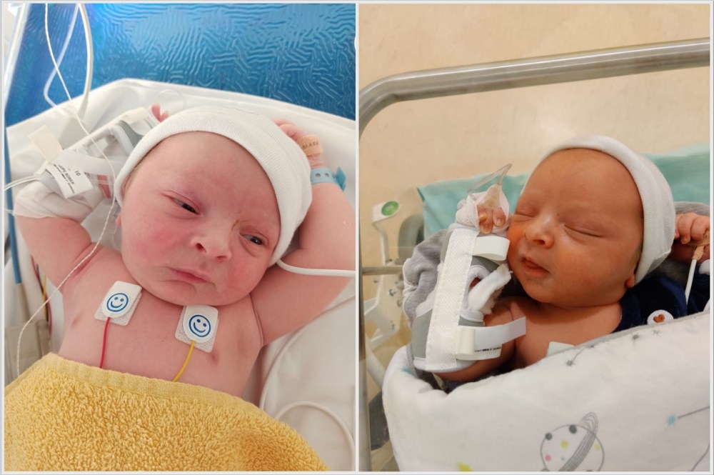 naissance hypotonique convulsion hypoglycémie